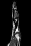 5 NMSP Circulation A21 - Bone case B6b.jpg